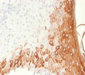 Keratin 10 Antibody rKRT10/1275 by IHC in Human Skin. Immunohistochemistry of FFPE human skin tissue using Keratin 10 Antibody rKRT10/1275. Strong brown cytoplasmic staining is observed in differentiated suprabasal keratinocytes, while the basal epidermal layer exhibits comparatively weak staining. The Recombinant CK10 Monoclonal Antibody highlights the expected distribution of KRT10 in stratified squamous epithelium. Nuclei are counterstained blue with hematoxylin. Heat-induced epitope retrieval was performed using 10 mM citrate buffer, pH 6, for 10-20 minutes, followed by cooling at room temperature for 20 minutes.