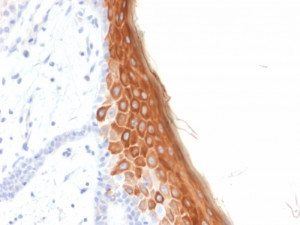 KRT10 Antibody rKRT10/844 by IHC in Human Skin. Immunohistochemistry of FFPE human skin tissue using KRT10 Antibody rKRT10/844. Strong brown cytoplasmic staining is observed in the suprabasal epidermal layers, with comparatively little staining in the basal keratinocytes and underlying dermis. The Recombinant Keratin 10 Antibody highlights differentiated epidermal cells, consistent with the expected distribution of KRT10 in stratified squamous epithelium. Nuclei are counterstained blue with hematoxylin. Heat-induced epitope retrieval was performed using 10 mM citrate buffer, pH 6, for 10-20 minutes, followed by cooling at room temperature for 20 minutes.