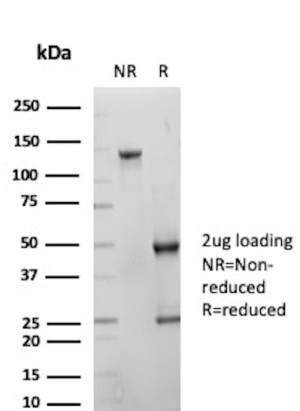 KRT10 Antibody rKRT10/844 by SDS-PAGE. SDS-PAGE analysis of purified KRT10 Antibody rKRT10/844 under non-reducing (NR) and reducing (R) conditions, with 2 ug of antibody loaded per lane. The non-reducing lane shows a prominent band migrating at approximately 130-150 kDa, consistent with intact IgG. Under reducing conditions, distinct bands are observed at approximately 50 kDa and 25 kDa, corresponding to the immunoglobulin heavy and light chains, respectively. The Recombinant Keratin 10 Antibody demonstrates the expected electrophoretic profile of a purified mouse monoclonal antibody preparation.