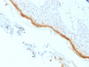 Recombinant Filaggrin Antibody Skin IHC. Immunohistochemistry analysis of FFPE human skin with recombinant Filaggrin antibody (clone rFLG/1561). Required HIER: boil tissue sections in 10mM citrate buffer, pH 6, for 10-20 min followed by cooling at RT for 20 min.