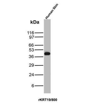 Recombinant CK19 Antibody rKRT19/800 in WB. Western Blot analysis of human skin tissue lysate using Cytokeratin 19 Antibody (clone rKRT19/800).