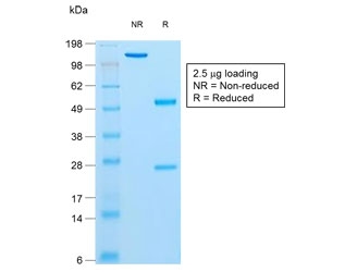 SDS-PAGE analysis of purified, BSA-free recombinant Insulin antibody (clone rIRDN/805) as confirmation of integrity and purity.