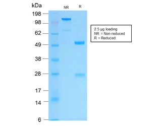 SDS-PAGE analysis of purified, BSA-free recombinant Keratin 16 antibody (clone KRT16/2043R) as confirmation of integrity and purity.