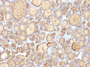 TG Antibody Recombinant Mouse MAb r6E1. Immunohistochemistry analysis of Thyroglobulin using TG Antibody Recombinant Mouse MAb r6E1 in FFPE human thyroid gland tissue section. HRP-DAB brown chromogenic staining highlights strong cytoplasmic signal in thyroid follicular epithelial cells forming thyroid follicles, with prominent staining of follicular luminal colloid material. The staining pattern is characteristic of Thyroglobulin expression in normal thyroid follicular epithelium and reflects its established role as a marker of thyroid follicular cell differentiation.
