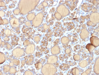 TG Antibody Recombinant Mouse MAb r6E1. Immunohistochemistry analysis of Thyroglobulin using TG Antibody Recombinant Mouse MAb r6E1 in FFPE human thyroid gland tissue section. HRP-DAB brown chromogenic staining highlights cytoplasmic signal in thyroid follicular epithelial cells forming well defined thyroid follicles, with strong staining of follicular luminal colloid material. The staining pattern is characteristic of Thyroglobulin expression in normal thyroid follicular epithelium and supports its role as a marker of thyroid follicular cell differentiation.