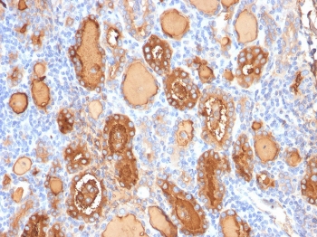 Thyroglobulin Antibody Recombinant Mouse MAb r2H11. Immunohistochemistry analysis of Thyroglobulin using Thyroglobulin Antibody Recombinant Mouse MAb r2H11 in FFPE human thyroid gland tissue section. HRP-DAB brown chromogenic staining highlights strong cytoplasmic signal in thyroid follicular epithelial cells forming thyroid follicles, with additional staining of follicular luminal colloid material. The staining pattern is characteristic of Thyroglobulin expression in normal thyroid follicular epithelium and reflects its role as a marker of thyroid follicular cell differentiation.
