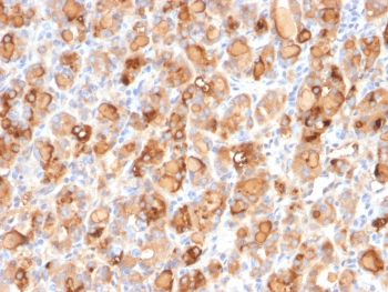 Thyroglobulin Antibody Recombinant Mouse MAb r2H11. Immunohistochemistry analysis of Thyroglobulin using Thyroglobulin Antibody Recombinant Mouse MAb r2H11 in FFPE human thyroid gland tissue section. HRP-DAB brown chromogenic staining highlights strong cytoplasmic signal in thyroid follicular epithelial cells forming thyroid follicles, with prominent staining of follicular luminal colloid material. The staining pattern is characteristic of Thyroglobulin expression in normal thyroid follicular epithelium and reflects its established role as a marker of thyroid follicular cell differentiation.