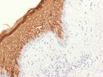 Immunohistochemistry of CK10 antibody in human skin tissue. FFPE human skin shows strong cytoplasmic HRP-DAB brown staining in suprabasal keratinocytes within the spinous and granular layers of stratified squamous epithelium, consistent with Cytokeratin 10 localization during epidermal differentiation, while basal keratinocytes remain largely negative. Clone KRT10/1948R was used for detection as a rabbit monoclonal antibody. Heat-induced epitope retrieval was performed by boiling tissue sections in pH 6, 10 mM citrate buffer for 10-20 minutes followed by cooling at room temperature for 20 minutes prior to staining.