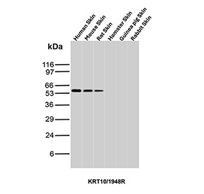 Western blot analysis of CK10 antibody in skin tissue lysates from multiple species. Lysates from human skin, mouse skin, and rat skin show a clear immunoreactive band at approximately 56-60 kDa, consistent with the predicted molecular weight of Cytokeratin 10 / KRT10. No distinct band is observed in hamster skin, guinea pig skin, or rabbit skin under the conditions tested. Clone KRT10/1948R was used as a recombinant rabbit monoclonal antibody for detection under reducing conditions.
