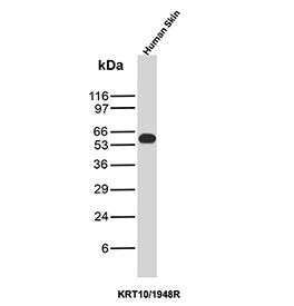 Western blot analysis of CK10 antibody in human skin tissue. Lysate from human skin shows a distinct immunoreactive band at approximately 56-60 kDa, consistent with the predicted molecular weight of Cytokeratin 10 / KRT10. Clone KRT10/1948R was used as a recombinant rabbit monoclonal antibody for detection under reducing conditions.