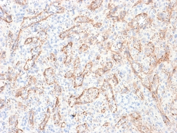 TL1A Antibody Spleen IHC. Immunohistochemistry staining of FFPE human spleen tissue using recombinant monoclonal clone rVEGI/1283 demonstrates membranous and cytoplasmic HRP-DAB brown staining predominantly within vascular endothelial structures and scattered stromal-associated cells, consistent with expression of TL1A / TNFSF15 in vascular and immune-regulatory tissue compartments. The observed staining pattern aligns with the established role of this TNF superfamily cytokine in inflammatory signaling, endothelial biology, and immune pathway regulation. Heat-induced epitope retrieval was performed by boiling sections in 10 mM Tris with 1 mM EDTA, pH 9, for 10-20 min followed by cooling at room temperature for 20 min prior to staining.