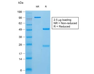 SDS-PAGE analysis of purified, BSA-free TG Antibody Recombinant Rabbit MAb TGB/1970R as confirmation of integrity and purity.