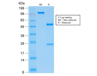 SDS-PAGE analysis of purified, BSA-free recombinant PTH antibody (clone PTH/2295R) as confirmation of integrity and purity.