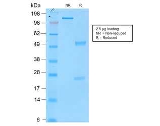 SDS-PAGE analysis of purified, BSA-free recombinant Tyrosinase antibody (clone rOCA1/812) as confirmation of integrity and purity.