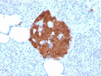 IHC staining of FFPE human pancreas tissue with PGP9.5 antibody (clone rUCHL1/775). Required HIER: boil tissue sections in pH 9 10mM Tris with 1mM EDTA for 10-20 min followed by cooling at RT for 20 min.