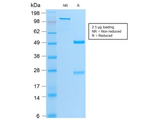 SDS-PAGE analysis of purified, BSA-free recombinant MyoD antibody (clone MYOD1/2075R) as confirmation of integrity and purity.