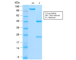 SDS-PAGE analysis of purified, BSA-free recombinant MyoD1 antibody (clone rMYD712) as confirmation of integrity and purity.