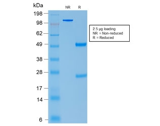 SDS-PAGE analysis of purified, BSA-free recombinant ACTH antibody (clone CLIP/2040R) as confirmation of integrity and purity.