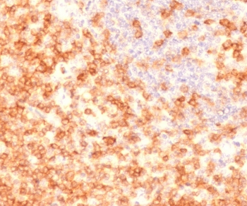 CD27 Antibody for IHC Tonsil Staining. Immunohistochemistry analysis of CD27 / TNFRSF7 expression in FFPE human tonsil tissue using CD27 Antibody / Memory B Cell Marker Antibody clone CDLA27-1R. Strong membranous HRP-DAB brown staining is observed in lymphocyte populations within germinal centers and surrounding mantle zones, consistent with CD27 expression on memory B cells and antigen-experienced lymphocytes, while adjacent stromal and epithelial elements remain largely negative. The staining pattern highlights memory B cell compartments and supports evaluation of humoral immune architecture within tonsillar tissue. Heat-induced epitope retrieval was performed in 10 mM Tris buffer with 1 mM EDTA, pH 9, for 10-20 minutes followed by cooling prior to antibody incubation.