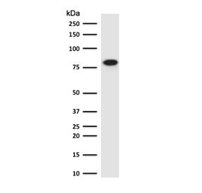 Beta Catenin Antibody Rabbit Monoclonal WB. Western blot testing of human HeLa antibody with recombinant Beta Catenin antibody (clone CTNB1-1R). Predicted molecular weight ~85 kDa, but routinely observed at 90-95 kDa.
