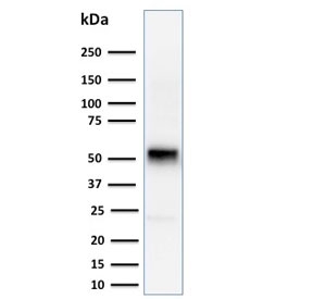 Cyclin E1 Antibody Human Jurkat Cell WB. Western blot analysis of human Jurkat cell lysate using Cyclin E1 Antibody / G1-S Cell Cycle Regulator Antibody demonstrates a prominent immunoreactive band at approximately 50 kDa, consistent with the predicted molecular weight of Cyclin E1 (CCNE1). Cyclin E1 is a key regulator of the G1-S transition that promotes DNA replication and cell cycle progression through formation of active complexes with CDK2. The observed band is consistent with expression of Cyclin E1 in Jurkat cells and supports its established role in regulating cellular proliferation, growth control, and progression through critical cell cycle checkpoints. A faint lower molecular weight band is also present and may represent a degradation product or minor antibody-reactive species.