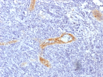 von Willebrand Factor Antibody / Endothelial Cell Marker Antibody. IHC testing of FFPE human tonsil with von Willebrand Factor Antibody (clone rVWF/1465). Required HIER: boil tissue sections in pH 9 10mM Tris with 1mM EDTA for 10-20 min followed by cooling at RT for 20 min.