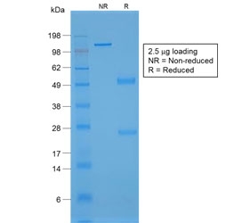 SDS-PAGE analysis of purified, BSA-free recombinant von Willebrand Factor antibody (clone rVWF/1465) as confirmation of integrity and purity.