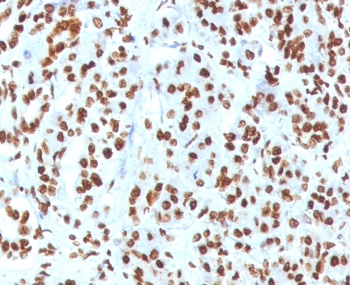 Histone H1 Antibody for IHC. Immunohistochemistry analysis of chromatin accessibility-associated histone H1 expression in FFPE human pancreas tissue using Histone H1 Antibody. Nuclear HRP-DAB brown staining is observed in pancreatic epithelial cells, consistent with localization of linker histone H1 within chromatin and its role in regulating DNA packaging and chromatin accessibility. Clone OSHT-3R antibody demonstrates strong nuclear compartmentalization with minimal cytoplasmic staining, reflecting chromatin-associated distribution across regions of regulated DNA accessibility.