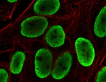Histone H1 Antibody for IF. Immunofluorescence analysis of chromatin accessibility-associated histone H1 expression in PFA-fixed human HeLa cells using Histone H1 Antibody (green). Strong nuclear staining is observed, consistent with localization of linker histone H1 within chromatin and its role in regulating DNA packaging and chromatin accessibility. Clone OSHT-3R antibody demonstrates uniform nuclear enrichment with minimal cytoplasmic signal, reflecting chromatin-associated distribution across regions of regulated chromatin accessibility. Actin filaments are labeled with phalloidin (red), providing cytoskeletal contrast to the chromatin-associated histone signal.