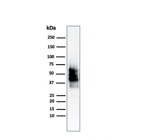 Western blot testing of human COLO-38 cell lysate with SOX10/Melanocytic Lineage antibody (clone SOX10/2311R). Expected molecular weight: 50-58 kDa.