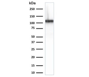 Cadherin 16 Antibody Human Kidney WB. Western blot analysis of Cadherin-16 / CDH16 expression in human kidney tissue lysate using Cadherin 16 antibody clone CDH16/2125. Lane 1: human kidney lysate. A band is detected at approximately 100â120 kDa, consistent with the predicted molecular weight of Cadherin-16 (CDH16), with the slightly higher apparent migration reflecting glycosylation of this kidney-restricted adhesion protein. The strong, distinct signal in kidney lysate supports the use of this antibody for kidney-specific expression analysis and aligns with the restricted distribution of CDH16 in renal epithelial tissue.