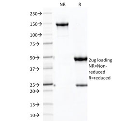 SDS-PAGE analysis of purified, BSA-free Cadherin 16 antibody (clone CDH16/2125) as confirmation of integrity and purity.