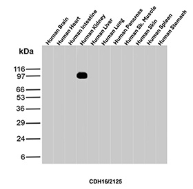 Cadherin 16 Antibody Multi-Tissue WB. Western blot analysis of Cadherin-16 / CDH16 expression across human tissue lysates using Cadherin 16 antibody clone CDH16/2125. Lane 1: human brain lysate, Lane 2: human heart lysate, Lane 3: human intestine lysate, Lane 4: human kidney lysate, Lane 5: human liver lysate, Lane 6: human lung lysate, Lane 7: human pancreas lysate, Lane 8: human skeletal muscle lysate, Lane 9: human skin lysate, Lane 10: human spleen lysate, Lane 11: human stomach lysate. A band is detected at approximately 100â110 kDa exclusively in kidney lysate, consistent with the predicted molecular weight of Cadherin-16 (CDH16), supporting its role as a kidney-specific epithelial adhesion protein.