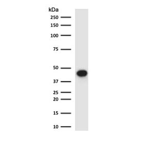 EpCAM Antibody Human Lung WB. Western blot testing of human lung lysate with EpCAM antibody (clone EPM17-5R). Expected molecular weight: ~35 kDa (unmodified), 40-43 kDa (glycosylated).