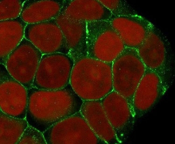 E-cadherin Antibody for IF. Immunofluorescence analysis of Cadherin 1 / CDH1 expression in human MCF7 cells using clone ECD1-3R antibody (green), showing strong membrane-associated staining outlining organized epithelial cell clusters, with Reddot nuclear stain (red). Signal highlights epithelial architecture, uniform cell packing, and well-defined cell boundaries consistent with structured epithelial organization.