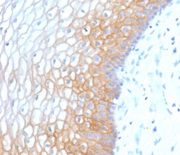 E-Cadherin Antibody Human Cervix IHC. Immunohistochemistry of formalin-fixed, paraffin-embedded human cervix stained with E-Cadherin antibody (clone ECD1-3R). Required HIER: boil tissue sections in 10mM citrate buffer, pH6, for 10-20 min followed by cooling at RT for 20 min.