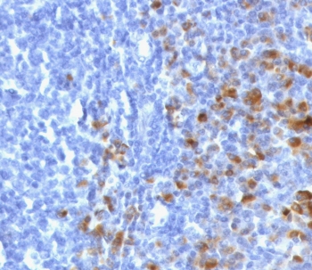 IHC staining of FFPE human tonsil tissue with recombinant IgG antibody (clone GHC07-2R). Required HIER: boil tissue sections in 10mM citrate buffer, pH6, for 10-20 min followed by cooling at RT for 20 min.