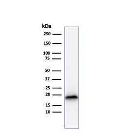 Melan-A Antibody WB. Western blot testing of human COLO-38 cell lysate with recombinant Melan-A antibody (clone rMLANA/788). Expected molecular weight ~20 kDa with possible doublet.