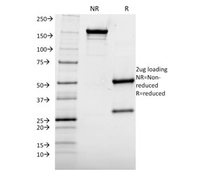 SDS-PAGE analysis of purified, BSA-free Albumin antibody (clone ALB/2144) as confirmation of integrity and purity.