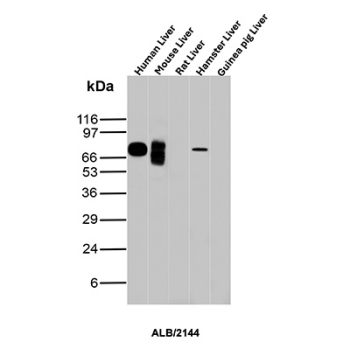 Albumin Antibody Liver Panel WB. Western blot analysis of human, mouse, rat, hamster, and guinea pig liver tissue lysates using Albumin antibody detects a strong band at approximately 65-70 kDa in human liver, with additional bands observed in mouse liver and a weaker band in rat liver, consistent with Albumin (ALB) expression across species; minimal signal is seen in hamster and guinea pig samples under these conditions. Detection was performed with clone ALB/2144.