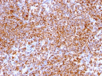 IHC testing of FFPE human lymph node tissue with recombinant CD20 antibody (clone rIGEL/773). HIER: boil tissue sections in pH 9 10mM Tris with 1mM EDTA for 20 min and allow to cool before testing.