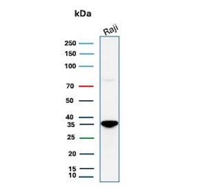 Western blot testing of human Raji cell lysate with recombinant CD20 antibody. Predicted molecular weight ~33 kDa.