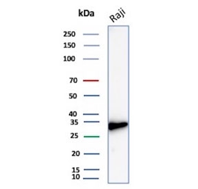 Western blot testing of human Raji cell lysate with recombinant CD20 antibody. Predicted molecular weight ~33 kDa.