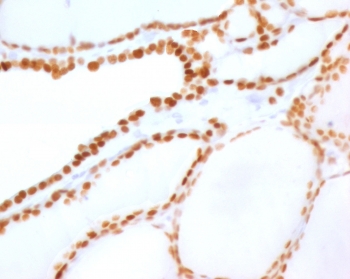NKX2.1 Antibody / Thyroid Transcription Factor Antibody (clone HBNK2-2R). Immunohistochemistry analysis of human thyroid tissue. FFPE human thyroid sections demonstrate strong HRP-DAB brown nuclear staining in thyroid follicular epithelial cells lining the thyroid follicles, consistent with expression of the NKX2.1 thyroid lineage transcription factor within differentiated thyroid epithelium. The nuclear staining pattern highlights NKX2.1 as a key thyroid transcription factor regulating gene expression programs that control thyroid epithelial differentiation and thyroid hormone biosynthesis. Positive nuclei are distributed throughout follicular epithelial cells surrounding colloid-filled follicles, reflecting the role of NKX2.1 in maintaining transcriptional regulation of thyroid-specific genes within thyroid follicular cells. Surrounding stromal cells and non-epithelial elements show minimal staining. Required HIER: boil tissue sections in pH6, 10mM citrate buffer, for 10-20 minutes followed by cooling at room temperature for 20 minutes prior to antibody incubation.
