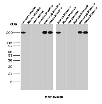SMMHC Antibody Gastrointestinal Tissues WB. Western blot analysis of multiple gastrointestinal tissue lysates using SMMHC Antibody clone MYH11/2303R. Samples include human, mouse, rat, hamster, guinea pig, and rabbit intestine, as well as stomach tissues from the same species. MYH11, also known as Smooth Muscle Myosin Heavy Chain (SMMHC), is a contractile protein highly enriched in visceral smooth muscle cells and serves as a marker of smooth muscle differentiation. A prominent band is detected at approximately 200 kDa in human, guinea pig, and rabbit intestine, consistent with the expected molecular weight of MYH11. Species-dependent differences in signal intensity likely reflect variation in expression levels and epitope conservation. These results demonstrate the utility of MYH11 Antibody for studies of smooth muscle biology, gastrointestinal physiology, and cross-species tissue analysis.