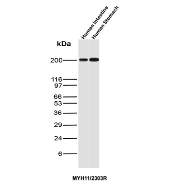SMMHC Antibody Stomach and Intestine Tissues WB. Western blot analysis of human intestine and human stomach tissue lysates using SMMHC Antibody clone MYH11/2303R. SMMHC, also known as Smooth Muscle Myosin Heavy Chain or MYH11, is a major contractile protein that serves as a highly specific marker of differentiated smooth muscle cells. A strong band is detected at approximately 200 kDa in both tissue samples, corresponding to the expected molecular weight of full length MYH11. The robust expression observed in gastrointestinal tissues is consistent with the abundance of smooth muscle layers responsible for peristalsis and organ motility. These results support the utility of SMMHC Antibody for studies of smooth muscle differentiation, gastrointestinal physiology, and visceral smooth muscle pathology.