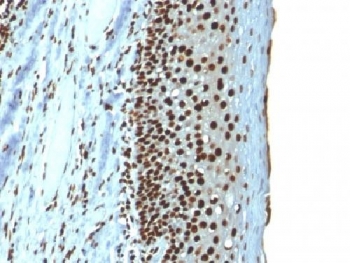 Histone H1 Antibody for IHC. Immunohistochemistry analysis of nuclear architecture-associated histone H1 expression in FFPE human tonsil tissue using Histone H1 Antibody. Nuclear HRP-DAB brown staining is observed in lymphoid cells, consistent with localization of linker histone H1 within chromatin domains and its role in chromatin compartmentalization and nuclear organization. Clone r1415-1 antibody demonstrates strong nuclear compartmentalization with minimal cytoplasmic staining, reflecting chromatin-associated distribution across organized nuclear domains.