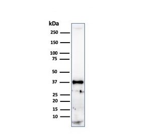 Histone H1 Antibody for WB. Western blot analysis of nuclear architecture-associated histone H1 expression in human heart tissue lysate. A band is detected at approximately 22-33 kDa, consistent with the predicted molecular weight range of Histone H1 family proteins, with lower bands corresponding to unmodified forms and higher bands reflecting post-translationally modified variants. The observed band pattern aligns with the role of histone H1 in chromatin domain organization and nuclear architecture.