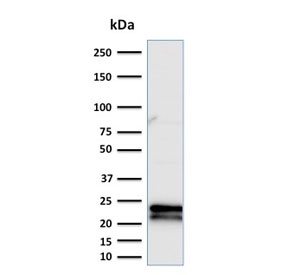 CD3e Antibody. Western blot analysis of CD3 Epsilon / CD3E antibody in human Jurkat cell lysate using CD3e Antibody / Microarray Specificity Validated Antibody (clone C3e/2479). A band is detected at approximately 20-25 kDa, consistent with the predicted molecular weight of CD3 epsilon. The clean band pattern with minimal background supports specific target recognition, aligning with the protein microarray validation profile of clone C3e/2479 and confirming reliable detection of CD3 epsilon in cell lysates.