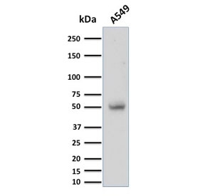 Western blot testing of human A549 cell lysate with CD14 antibody (clone LPSR/2397). Predicted molecular weight: 40-55 kDa depending on glycosylation level.